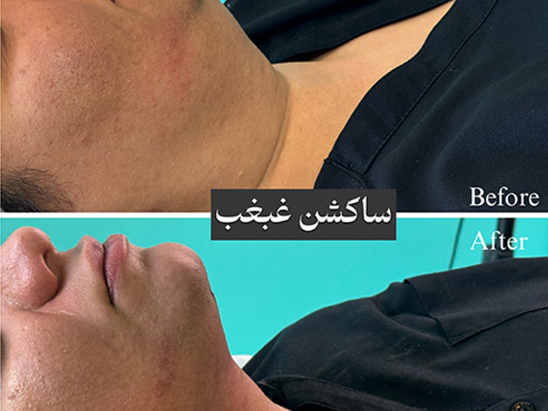 وقتی نیم‌رخ تغییر می‌کند؛ روایت یک تصمیم، نگرانی و رسیدن به فرم طبیعی‌تر صورت