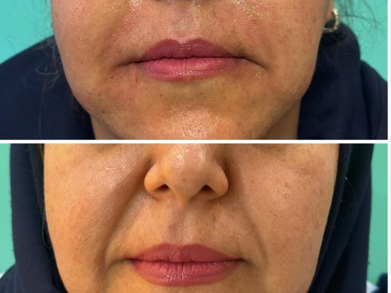 روایتی از یک تغییر کوچک؛ وقتی چهره دوباره شاداب‌تر به نظر می‌رسد